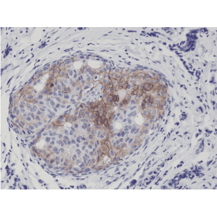 Immunohistochemistry - Anti-EGFR (phospho Tyr1173) Antibody [RM269] (A121410) - Antibodies.com