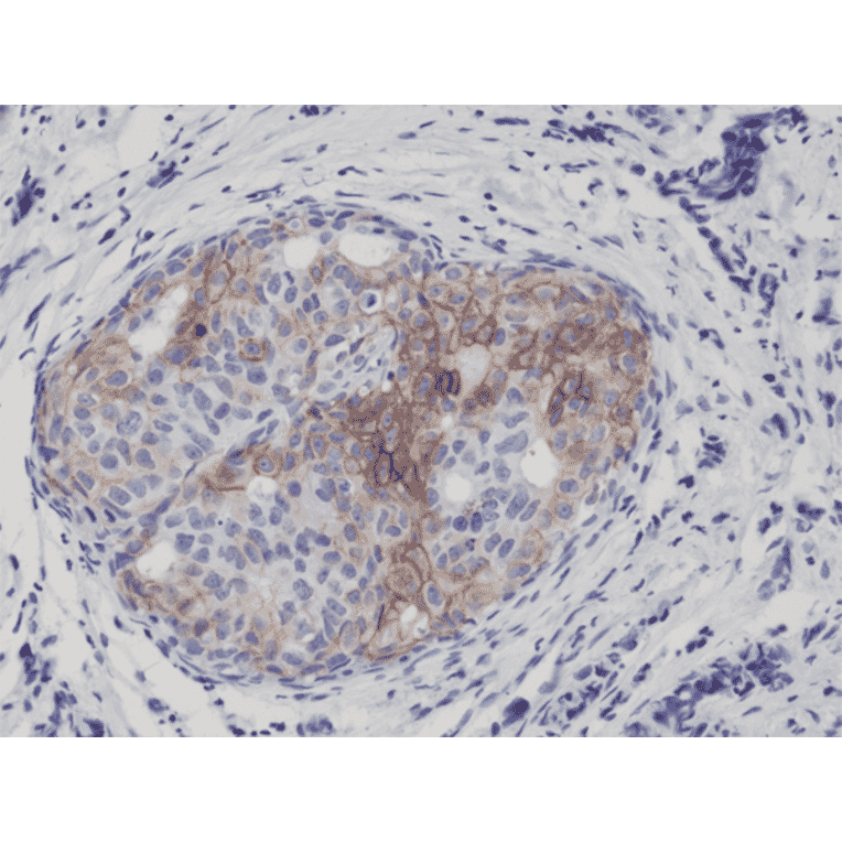 Immunohistochemistry - Anti-EGFR (phospho Tyr1173) Antibody [RM269] (A121410) - Antibodies.com