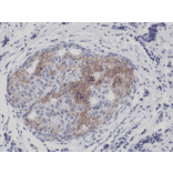 Immunohistochemistry - Anti-EGFR (phospho Tyr1173) Antibody [RM269] (A121410) - Antibodies.com