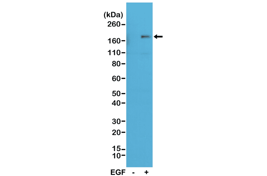 Western Blot - Anti-EGFR (phospho Tyr1173) Antibody [RM269] (A121246) - Antibodies.com