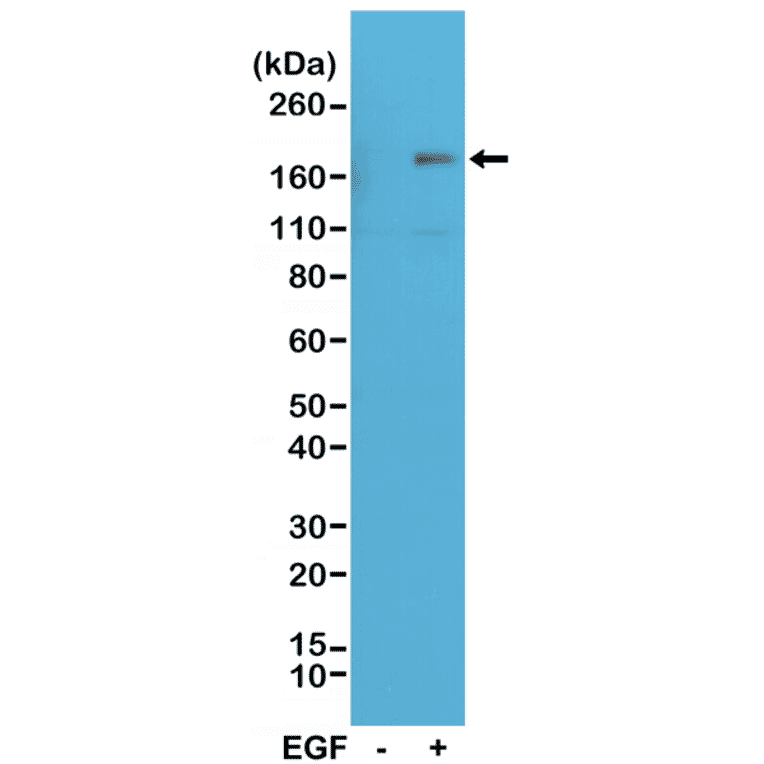 Western Blot - Anti-EGFR (phospho Tyr1173) Antibody [RM269] (A121246) - Antibodies.com