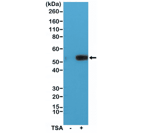 Western Blot - Anti-alpha Tubulin (acetyl Lys40) Antibody [RM318] (A121247) - Antibodies.com