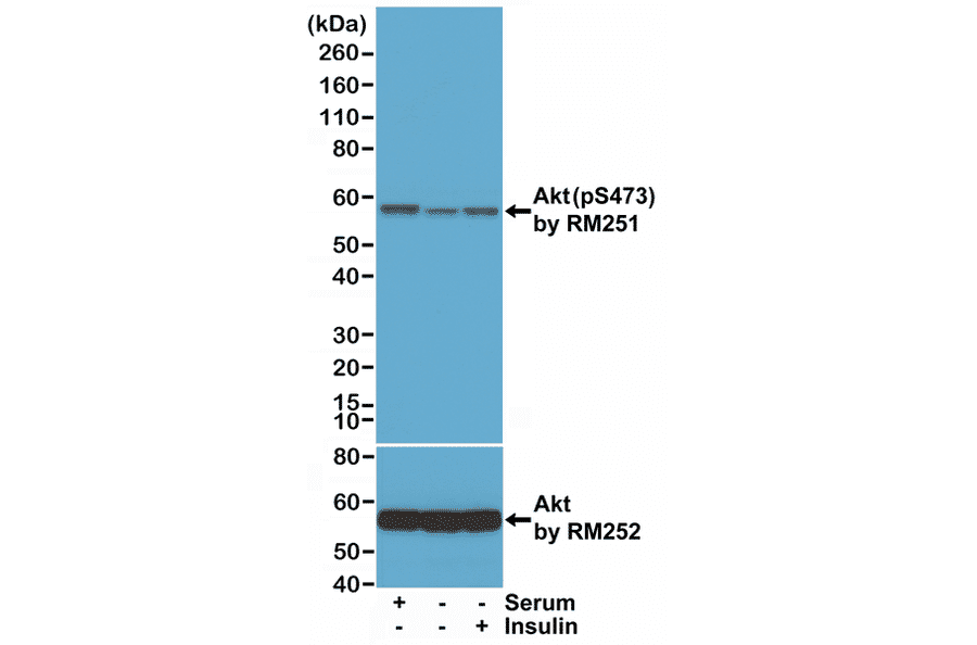 Western Blot - Anti-AKT (phospho Ser473) Antibody [RM251] (A121248) - Antibodies.com