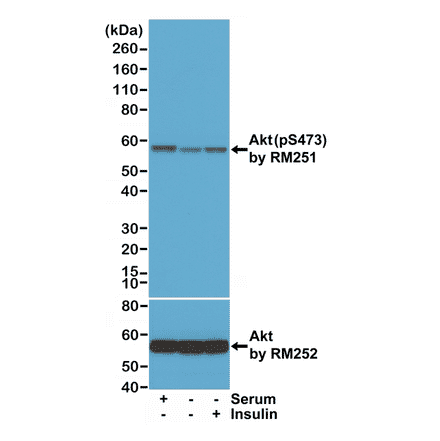 Western Blot - Anti-AKT (phospho Ser473) Antibody [RM251] (A121248) - Antibodies.com