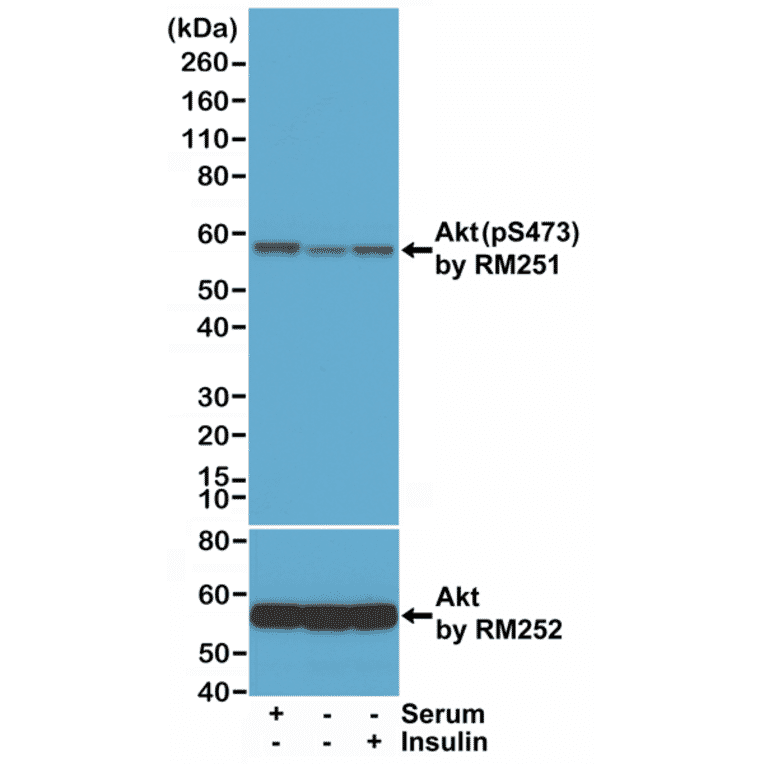 Western Blot - Anti-AKT (phospho Ser473) Antibody [RM251] (A121248) - Antibodies.com