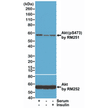 Western Blot - Anti-AKT (phospho Ser473) Antibody [RM251] (A121248) - Antibodies.com