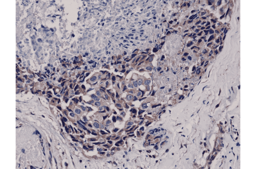 Immunohistochemistry - Anti-AKT (phospho Ser473) Antibody [RM251] (A121457) - Antibodies.com