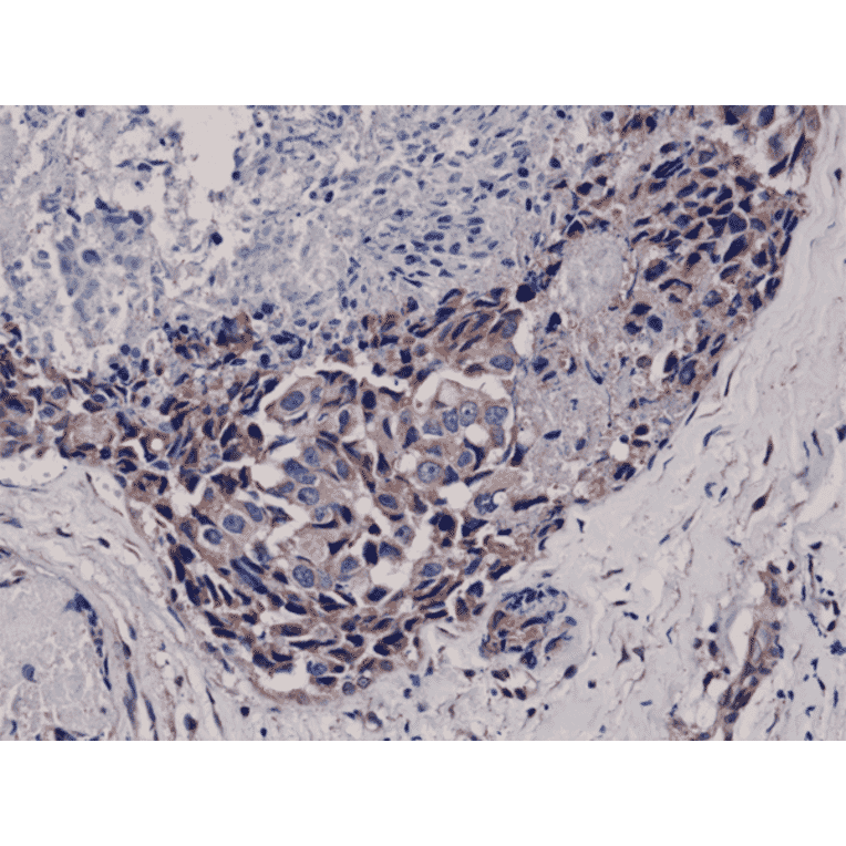 Immunohistochemistry - Anti-AKT (phospho Ser473) Antibody [RM251] (A121457) - Antibodies.com