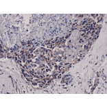 Immunohistochemistry - Anti-AKT (phospho Ser473) Antibody [RM251] (A121457) - Antibodies.com