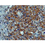 Immunohistochemistry - Anti-BRAF (mutated V600E) Antibody [RM8] (A121250) - Antibodies.com