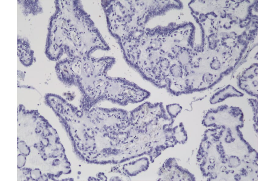 Immunohistochemistry - Anti-BRAF (mutated V600E) Antibody [RM8] (A121250) - Antibodies.com