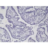Immunohistochemistry - Anti-BRAF (mutated V600E) Antibody [RM8] (A121250) - Antibodies.com