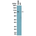 Western Blot - Anti-BRAF (mutated V600E) Antibody [RM8] (A121250) - Antibodies.com
