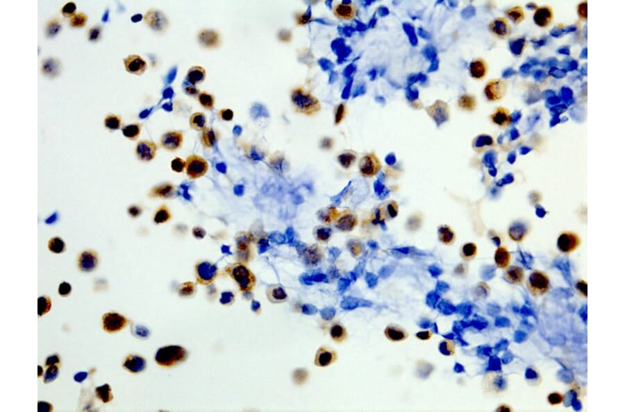 Immunohistochemistry - Anti-BRAF (mutated V600E) Antibody [RM8] (A121250) - Antibodies.com