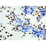 Immunohistochemistry - Anti-BRAF (mutated V600E) Antibody [RM8] (A121250) - Antibodies.com