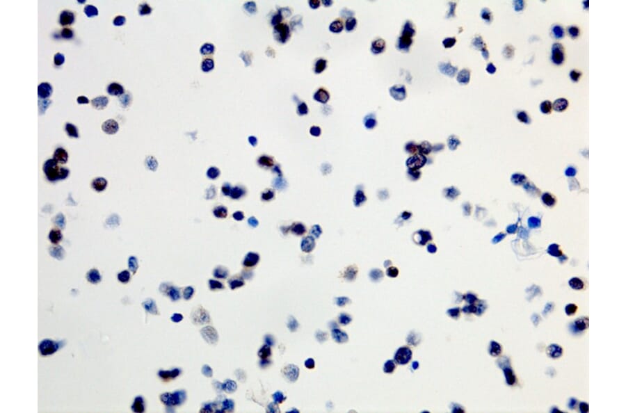 Immunohistochemistry - Anti-BRAF (mutated V600E) Antibody [RM8] (A121206) - Antibodies.com