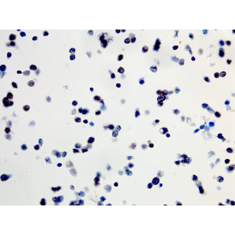 Immunohistochemistry - Anti-BRAF (mutated V600E) Antibody [RM8] (A121206) - Antibodies.com