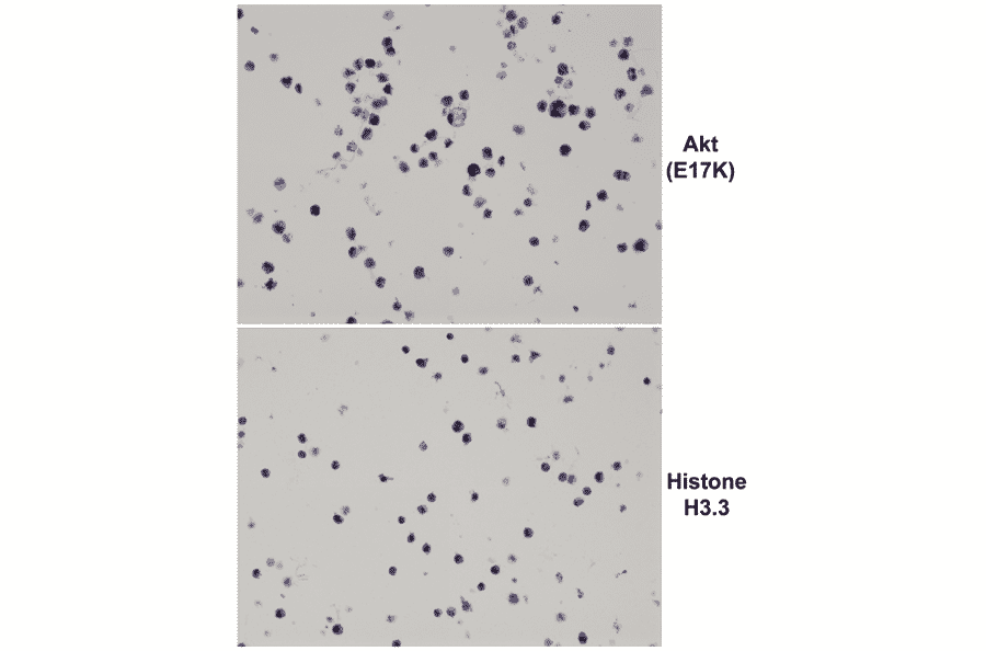 Immunohistochemistry - Anti-AKT (E17K mutant) Antibody [RM336] (A121434) - Antibodies.com