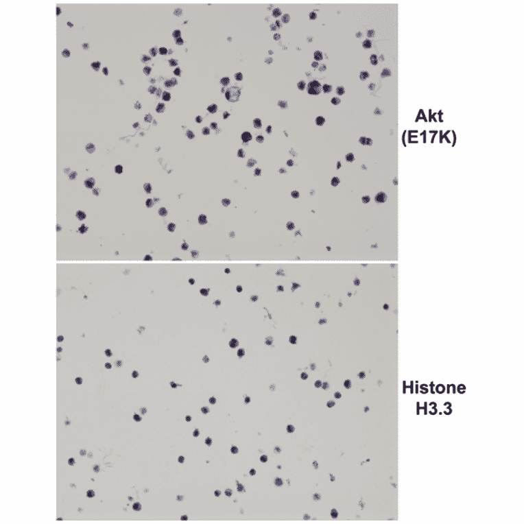 Immunohistochemistry - Anti-AKT (E17K mutant) Antibody [RM336] (A121434) - Antibodies.com