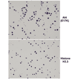Immunohistochemistry - Anti-AKT (E17K mutant) Antibody [RM336] (A121434) - Antibodies.com