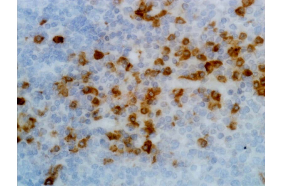 Immunohistochemistry - Anti-Human Kappa Light Chain Antibody (Biotin) [RM126] (A121253) - Antibodies.com