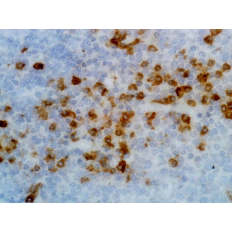Immunohistochemistry - Anti-Human Kappa Light Chain Antibody (Biotin) [RM126] (A121253) - Antibodies.com