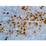 Immunohistochemistry - Anti-Human Kappa Light Chain Antibody (Biotin) [RM126] (A121253) - Antibodies.com