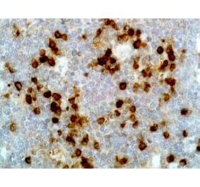 Immunohistochemistry - Anti-Human Lambda Light Chain Antibody (Biotin) [RM127] (A121255) - Antibodies.com
