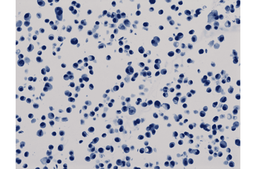 Immunohistochemistry - Anti-His Tag Antibody (Biotin) [RM146] (A121257) - Antibodies.com