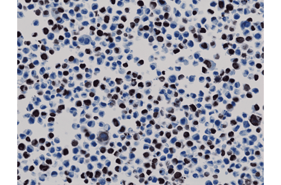 Immunohistochemistry - Anti-His Tag Antibody (Biotin) [RM146] (A121257) - Antibodies.com