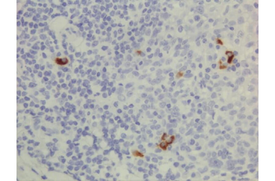 Immunohistochemistry - Anti-Human IgG3 Antibody (Biotin) [RM119] (A121271) - Antibodies.com