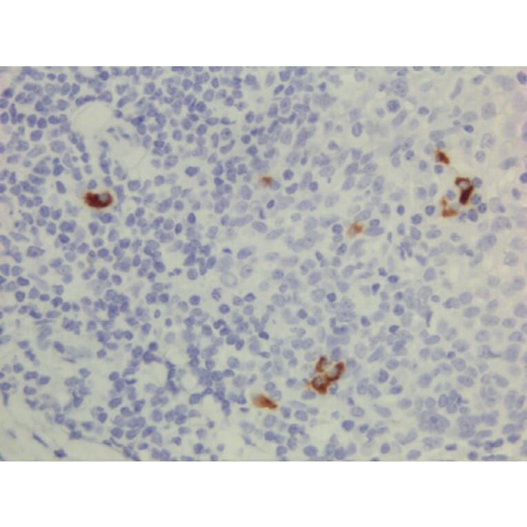 Immunohistochemistry - Anti-Human IgG3 Antibody (Biotin) [RM119] (A121271) - Antibodies.com