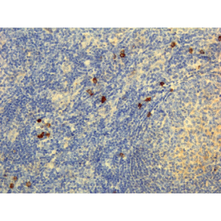 Immunohistochemistry - Anti-Human IgG4 Antibody (Biotin) [RM120] (A121272) - Antibodies.com