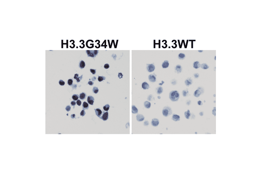 Immunohistochemistry - Anti-Histone H3.3 (G34W mutant) Antibody [RM263] (A121446) - Antibodies.com