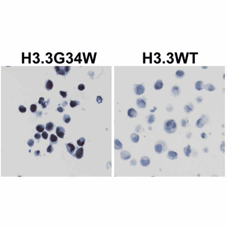 Immunohistochemistry - Anti-Histone H3.3 (G34W mutant) Antibody [RM263] (A121446) - Antibodies.com