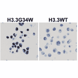 Immunohistochemistry - Anti-Histone H3.3 (G34W mutant) Antibody [RM263] (A121446) - Antibodies.com