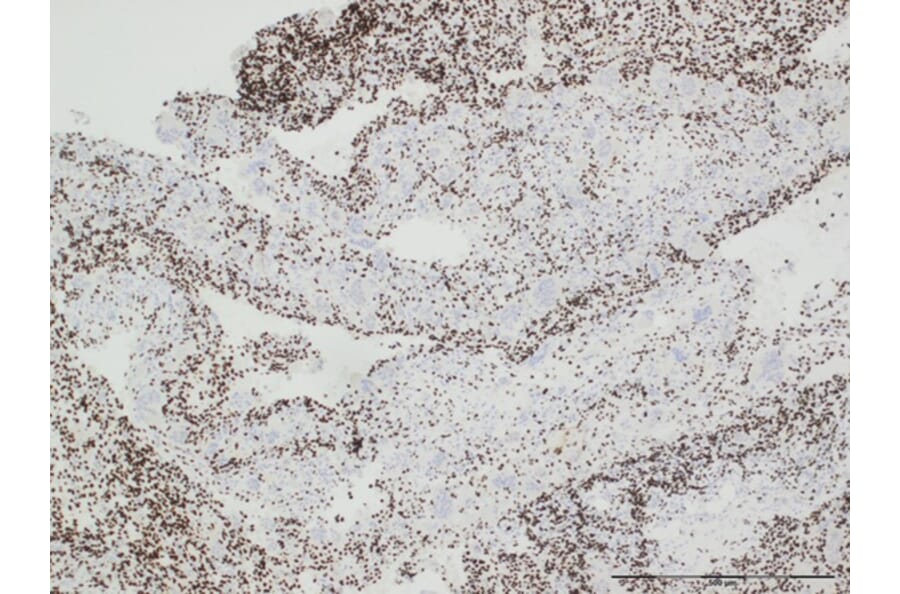 Immunohistochemistry - Anti-Histone H3.3 (G34W mutant) Antibody [RM263] (A121292) - Antibodies.com