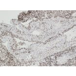Immunohistochemistry - Anti-Histone H3.3 (G34W mutant) Antibody [RM263] (A121292) - Antibodies.com