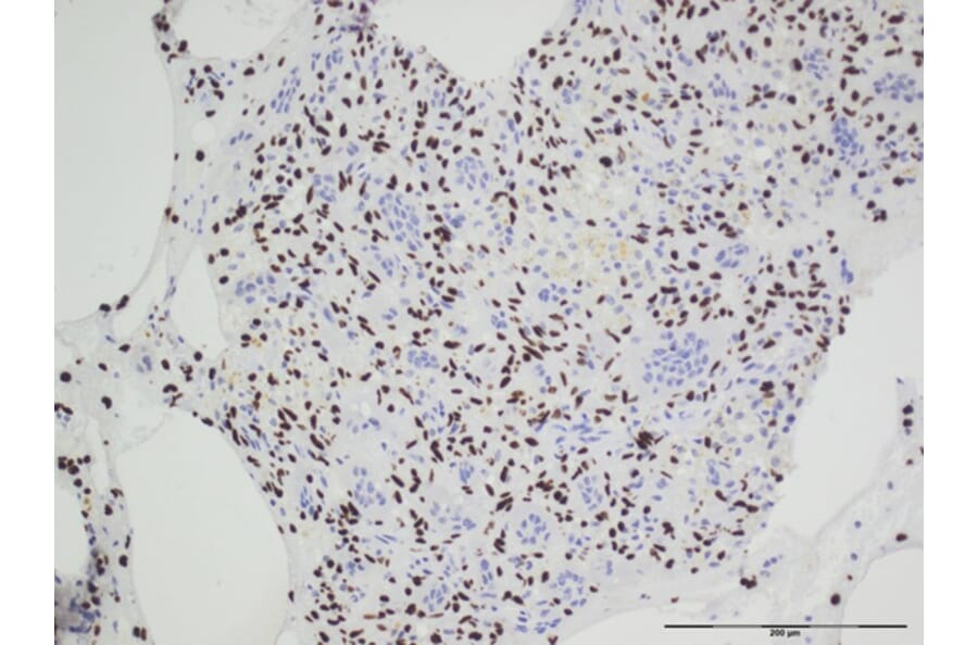 Immunohistochemistry - Anti-Histone H3.3 (G34W mutant) Antibody [RM263] (A121292) - Antibodies.com