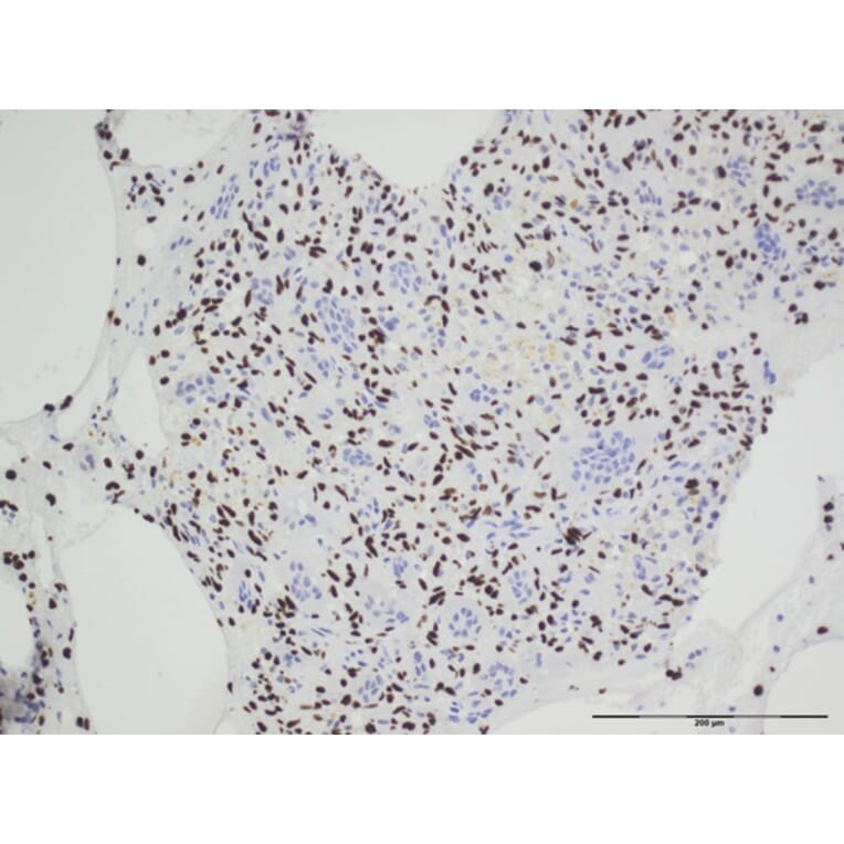 Immunohistochemistry - Anti-Histone H3.3 (G34W mutant) Antibody [RM263] (A121292) - Antibodies.com
