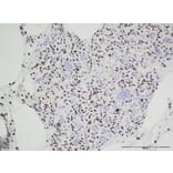 Immunohistochemistry - Anti-Histone H3.3 (G34W mutant) Antibody [RM263] (A121292) - Antibodies.com