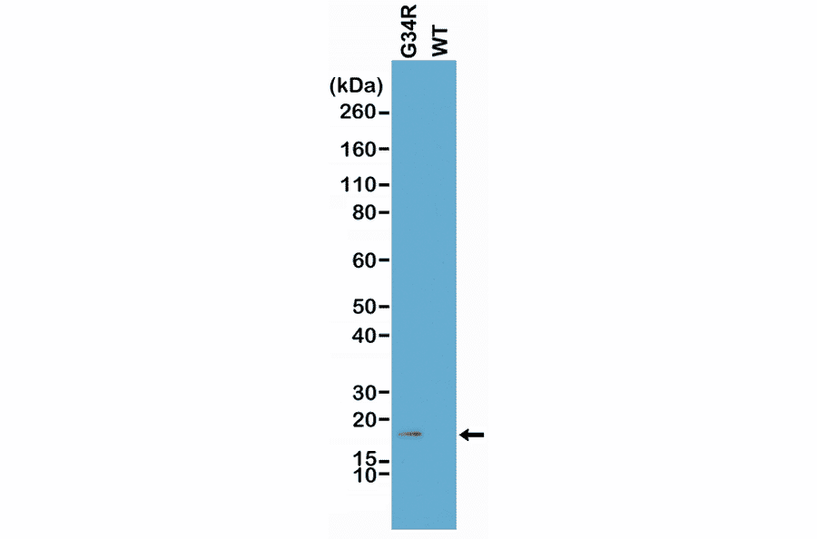 Western Blot - Anti-Histone H3.3 (G34R mutant) Antibody [RM240] (A121294) - Antibodies.com
