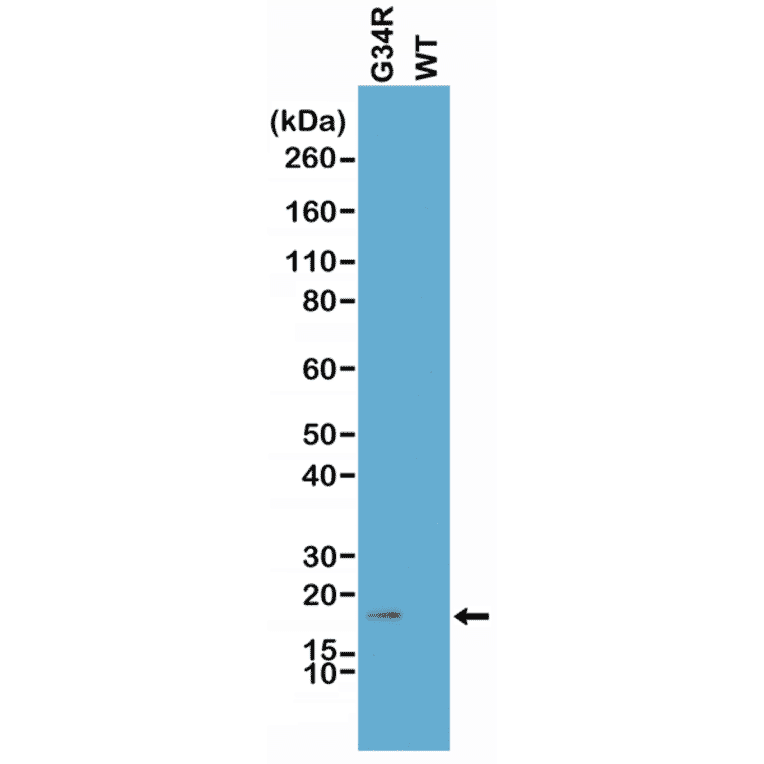 Western Blot - Anti-Histone H3.3 (G34R mutant) Antibody [RM240] (A121294) - Antibodies.com