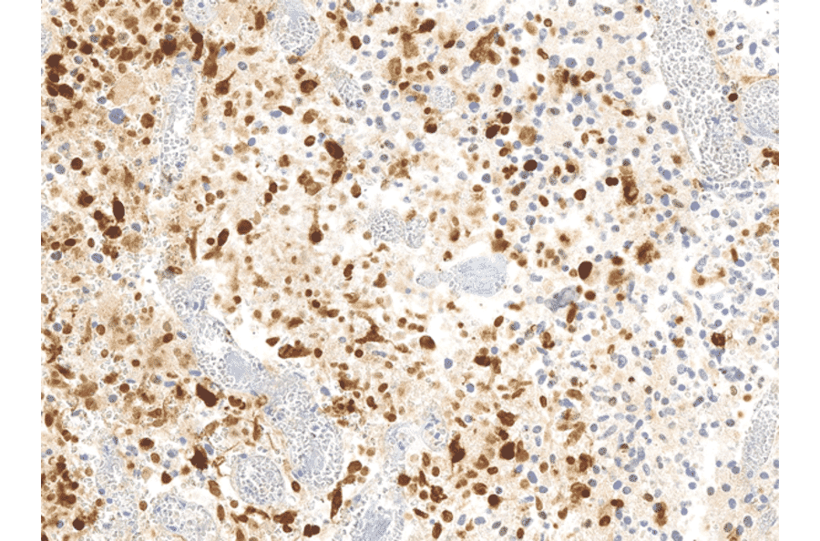 Immunohistochemistry - Anti-Histone H3.3 (G34R mutant) Antibody [RM240] (A121294) - Antibodies.com