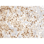 Immunohistochemistry - Anti-Histone H3.3 (G34R mutant) Antibody [RM240] (A121294) - Antibodies.com