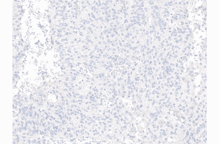 Immunohistochemistry - Anti-Histone H3.3 (G34R mutant) Antibody [RM240] (A121294) - Antibodies.com