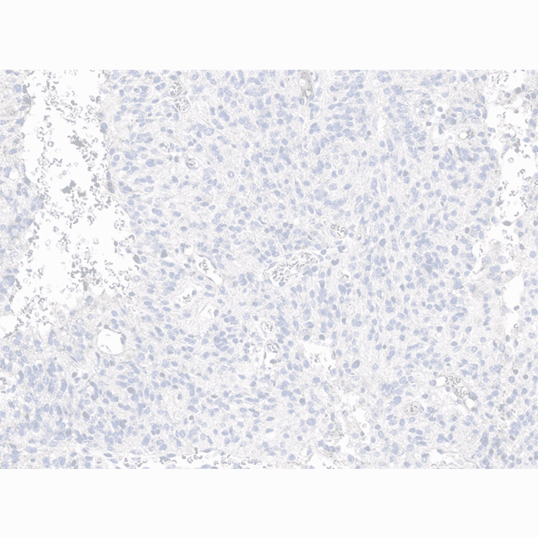 Immunohistochemistry - Anti-Histone H3.3 (G34R mutant) Antibody [RM240] (A121294) - Antibodies.com