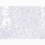 Immunohistochemistry - Anti-Histone H3.3 (G34R mutant) Antibody [RM240] (A121294) - Antibodies.com