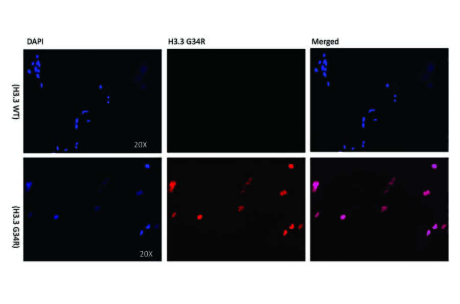 Immunocytochemistry - Anti-Histone H3.3 (G34R mutant) Antibody [RM240] (A121313) - Antibodies.com