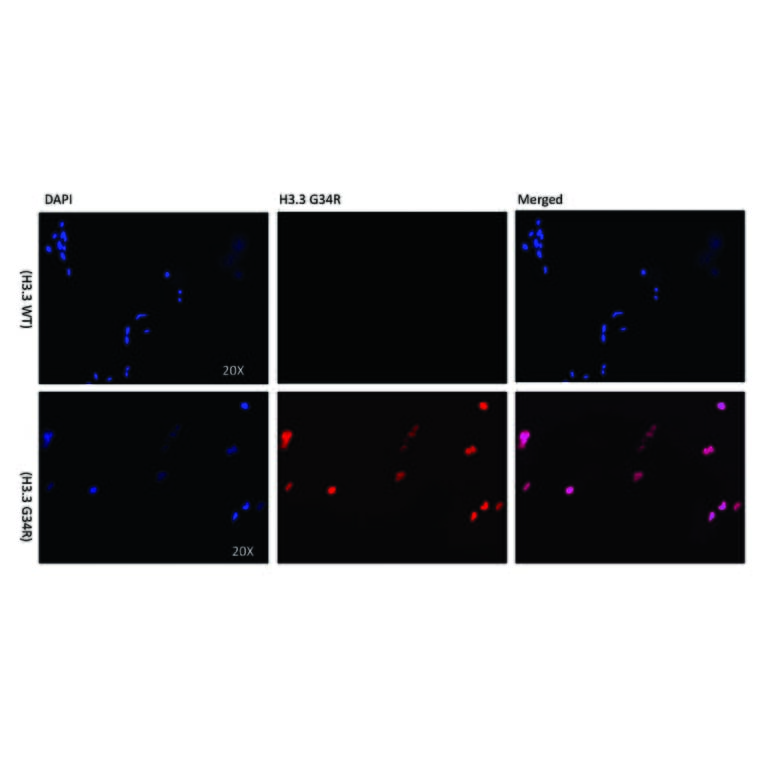 Immunocytochemistry - Anti-Histone H3.3 (G34R mutant) Antibody [RM240] (A121313) - Antibodies.com